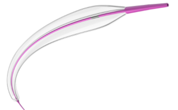 Tri-Wedge